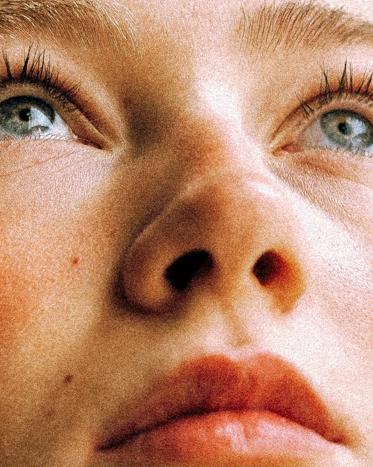 Nothing is Filtered: Where Skin and Self-Esteem Collide