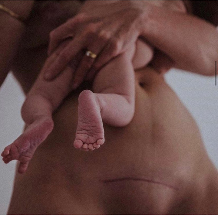 Expect Better: How to Navigate Skin, Hormones and Self–Identity in Preparation for Pregnancy, and Beyond